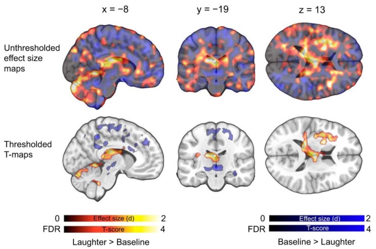  베타 엔돌핀(Beta endorphin)과 사교적 웃음(social laughter), 그리고 운동 후 기분전환과 우울증