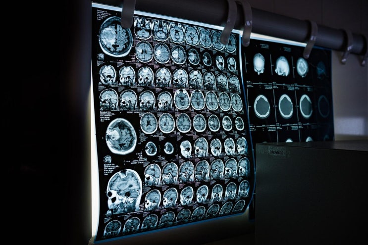 MRI CT의 장, 단점과 차이점 그리고 올바른 선택법