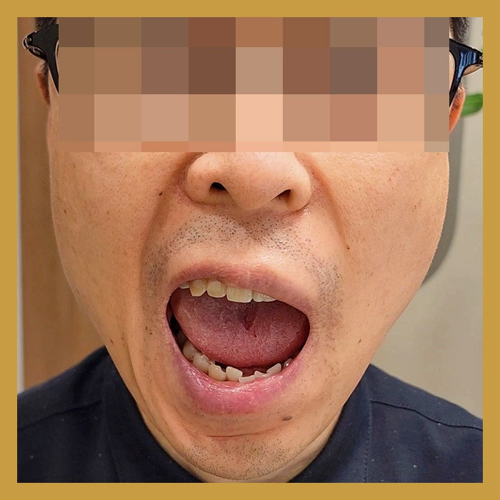 부산안면마비 수많은 환자들이 선택한 이유