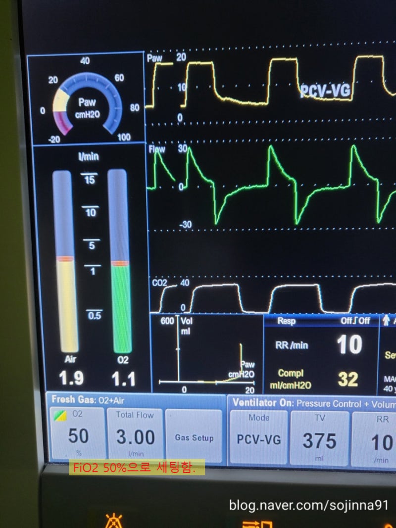 PaO2, SaO2, SpO2와의 차이점과 관계에 대해서. : 네이버 블로그
