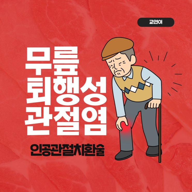  무릎퇴행성관절염 증상 치료 인공관절치환술이란?