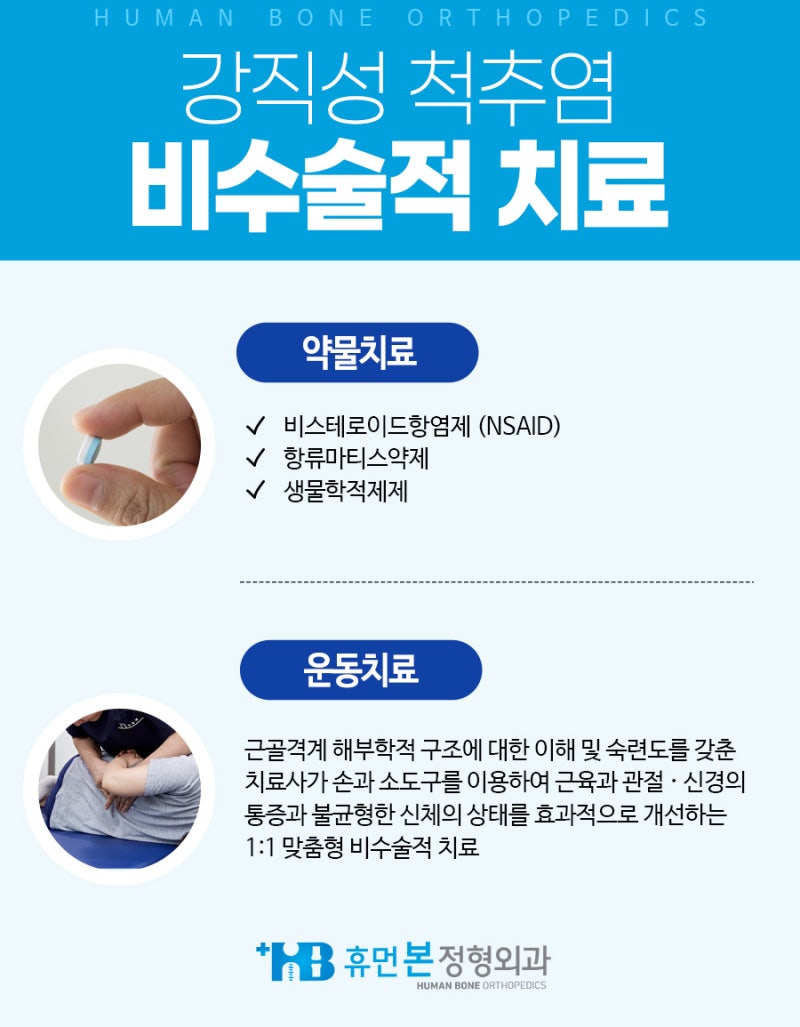 강직성척추염 운동치료 인천 부평 2