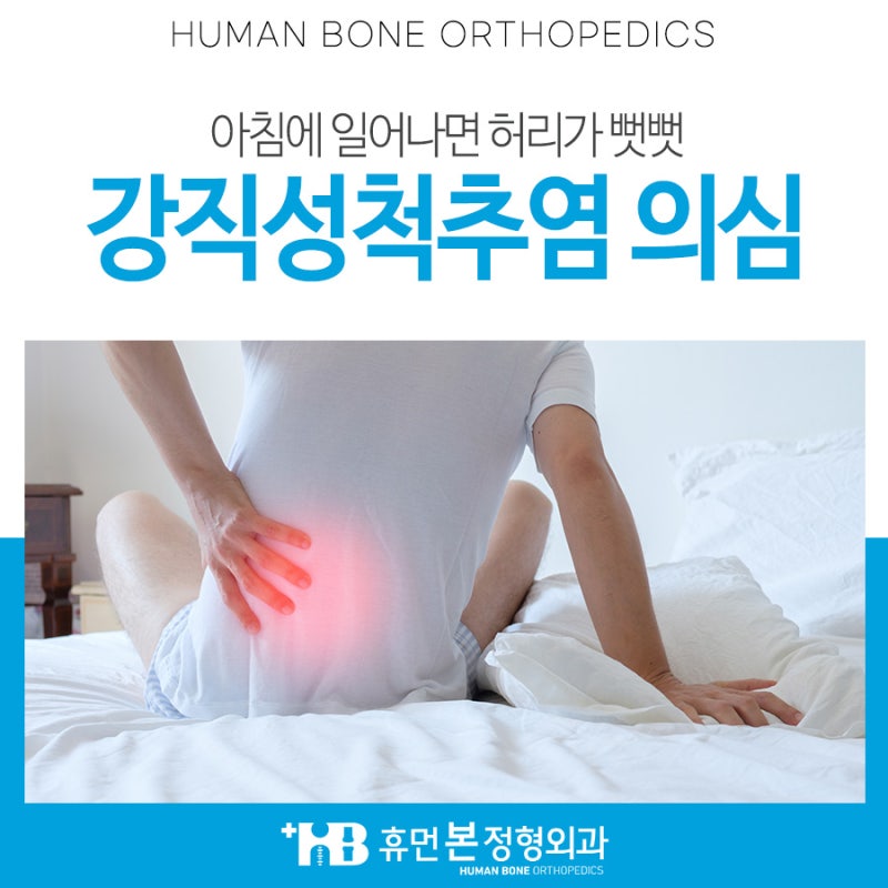 강직성척추염 운동치료 인천 부평 3
