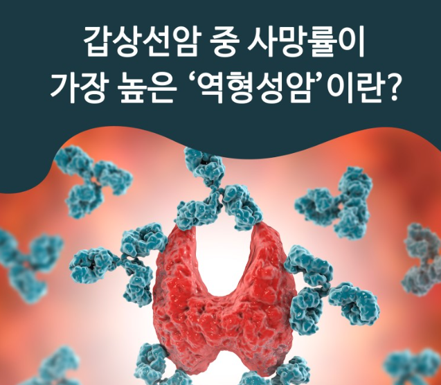  갑상선의 악성 종양 (3) - 갑상선 수질암(medullary thyroid cancer, MTC), 갑상선 역형성암(anaplastic thyroid cancer, ATC)