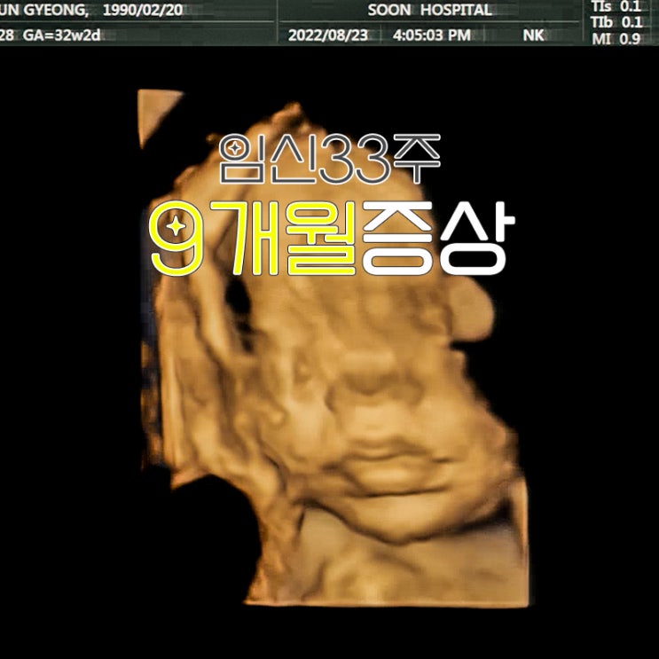  임신 33주 9개월 증상 임산부 배땡김 임신 소양증 심해져