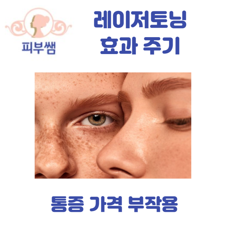  레이저토닝 효과 주기 통증 가격 부작용