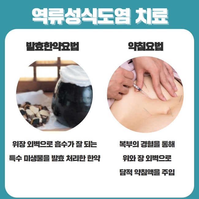 위역류성식도염 한방의