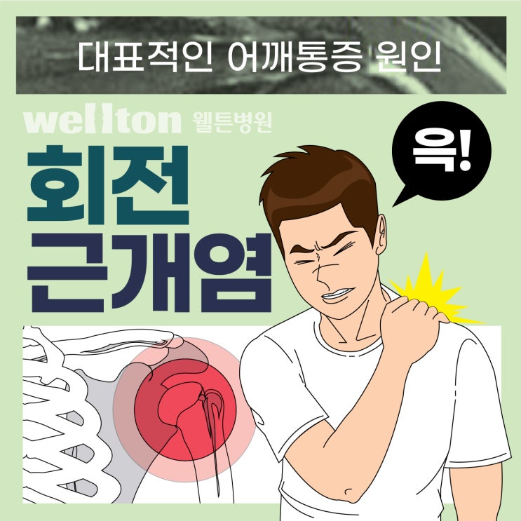  마곡나루정형외과 참으면 병되는 어깨회전근개염증