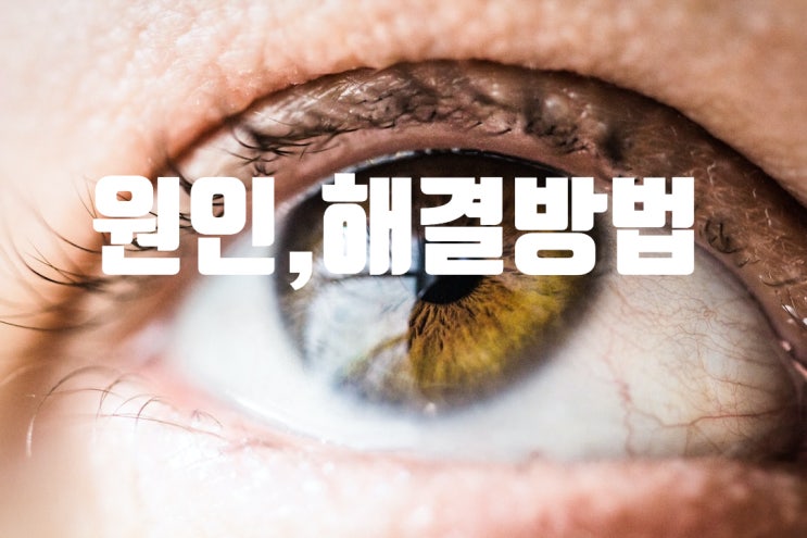 오른쪽 눈밑 떨림, 왼쪽 눈밑 떨림 원인 해결방법