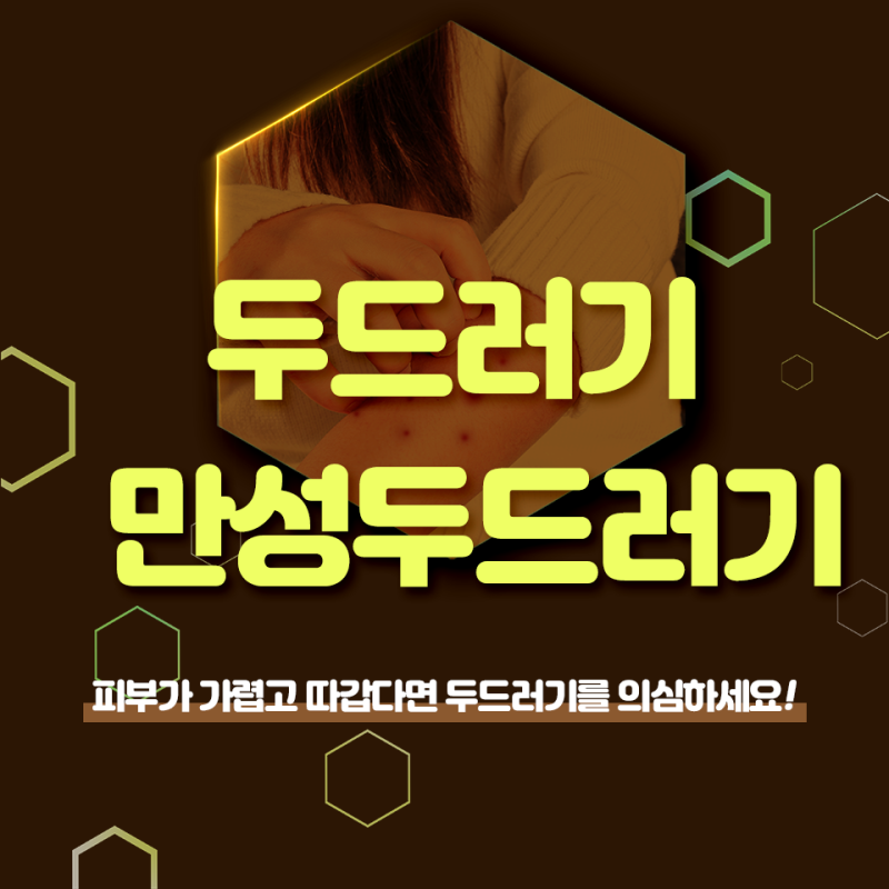 일산두드러기 가려움이 심해지면