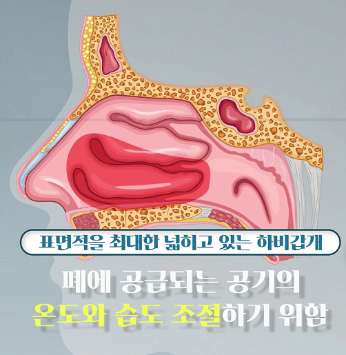  비염 수술, 비갑개 수술(Turbinate surgery), 하비갑개 비대(Inferior turbinate hypertrophy)