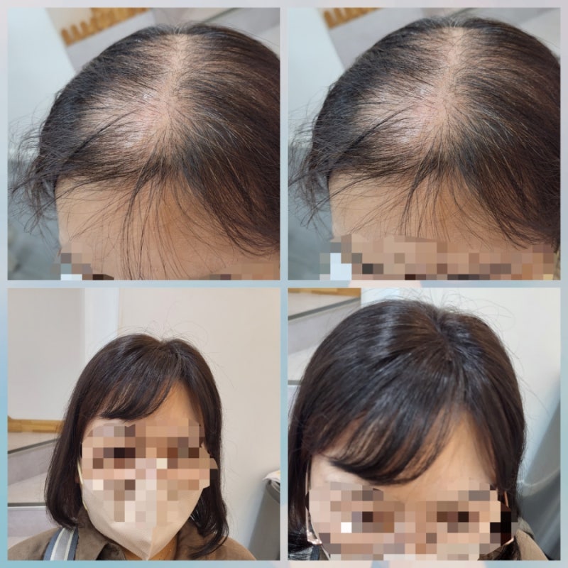 모앤미 여성가발 인천가발을 찾아와야 하는 이유를 알려드립니다. 1