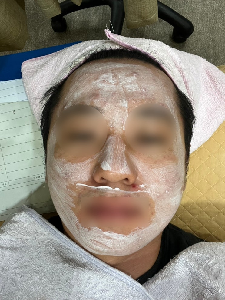  [하늘체한의원 인천] 여드름 압출 엄청 꼼꼼히 잘 해주세요.