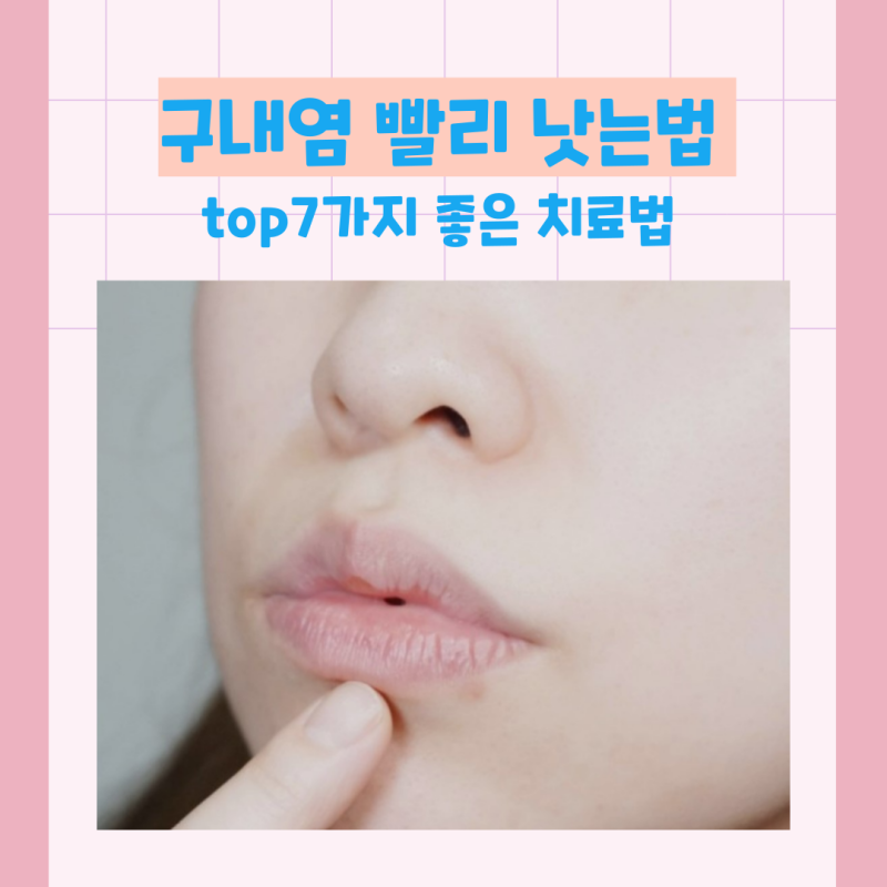 구내염(입병) 빨리 낫는법, 베스트 7가지 치료법 모음 : 네이버 블로그