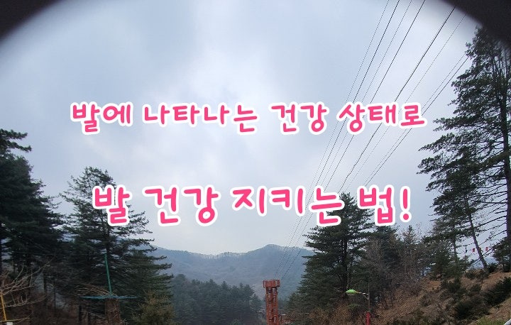 발에 나타나는 건강 상태로 발 건강 지키는 법! 발에 나타나는 건강 상태로 발 건강 지키는 법!