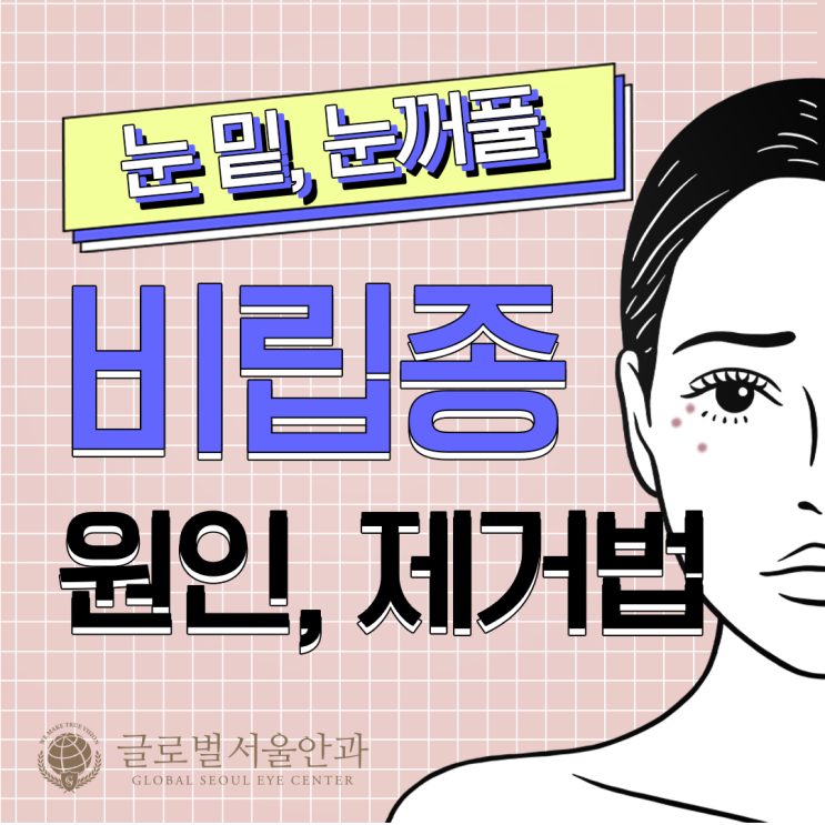 눈 주변에 오돌토돌한 비립종의 원인, 종류와 치료법 눈 주변에 오돌토돌한 비립종의 원인, 종류와 치료법