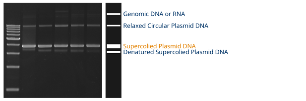 Plasmid DNA의 quality를 체크하는 방법(흡광도 비율, 전기영동, 엔도톡신 레벨)
