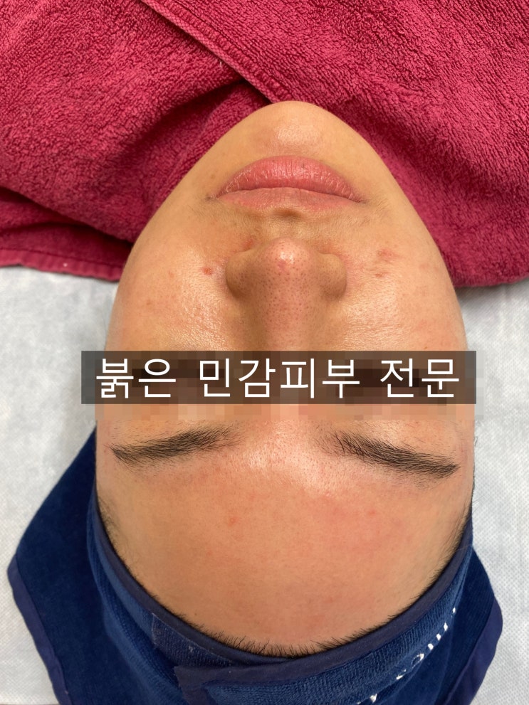  신중동 피부관리실 붉톤 고민이라면?