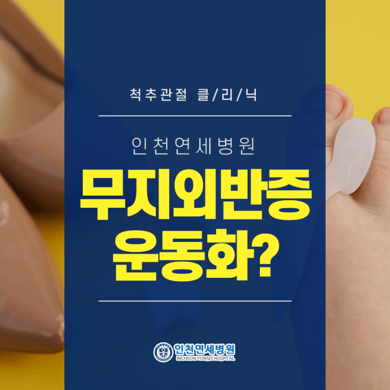 인천 무지외반증 운동화로도 통증이 지속된다면?