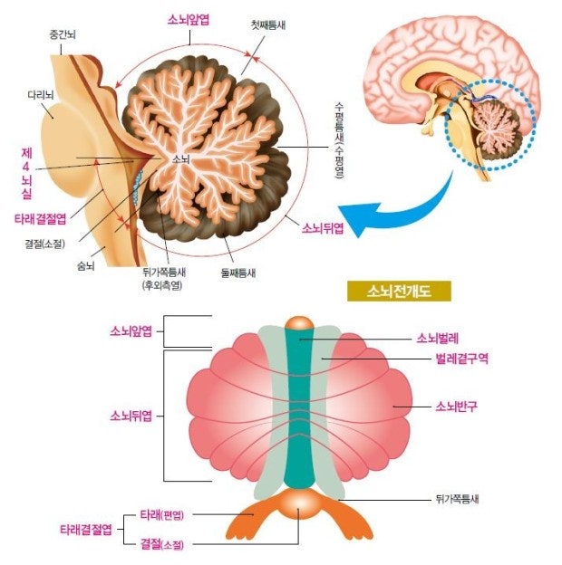 소뇌 (cerebellum) 손상 재활 치료 : 네이버 블로그