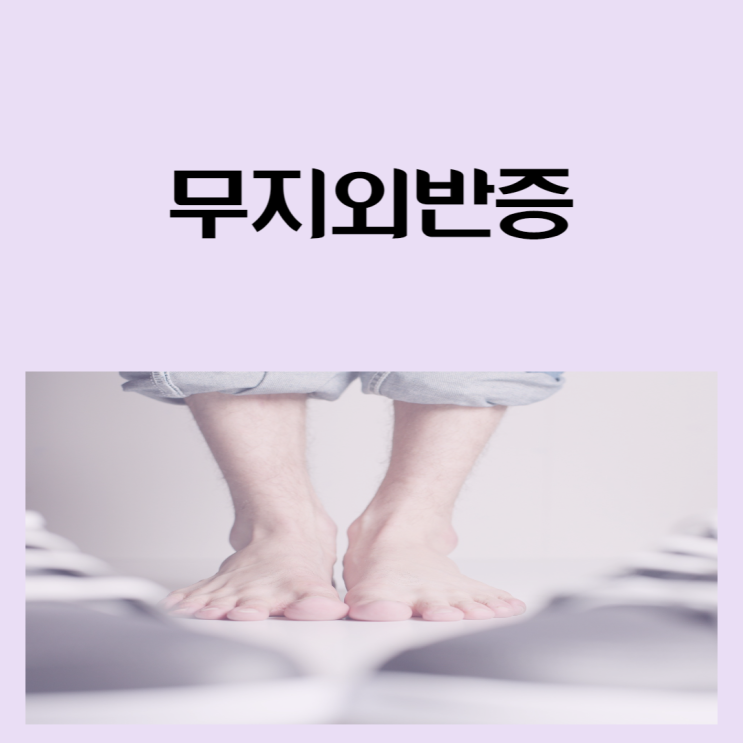 외지무반증 아닌 무지외반증