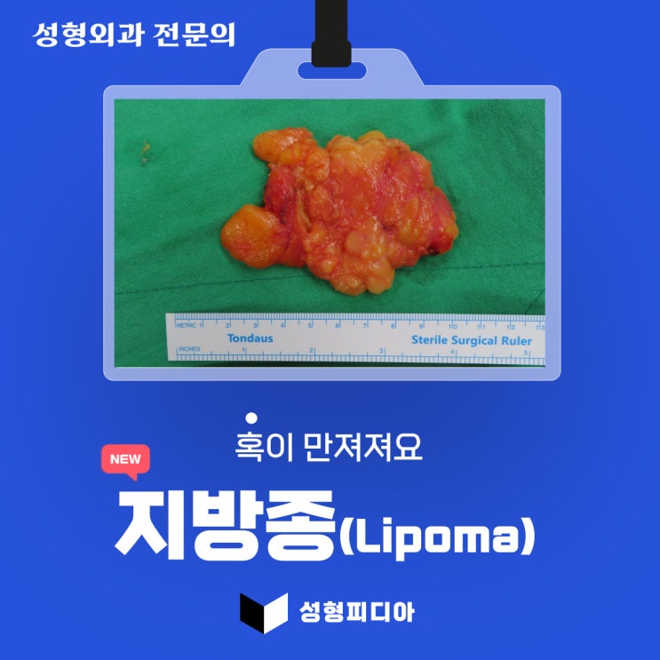  [지방종] 지방종이란 무엇인가요?