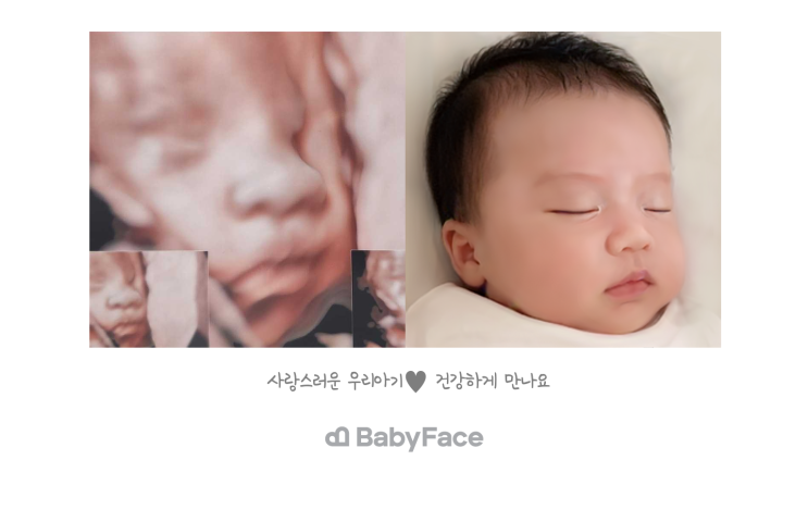  [임신36주차] 부산 산후도우미 신청, 베이비페이스, 아기용품준비, 막달증상 손저림 ㅠㅠ