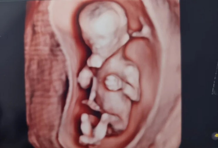  13주 2일차 보석이 성장일기