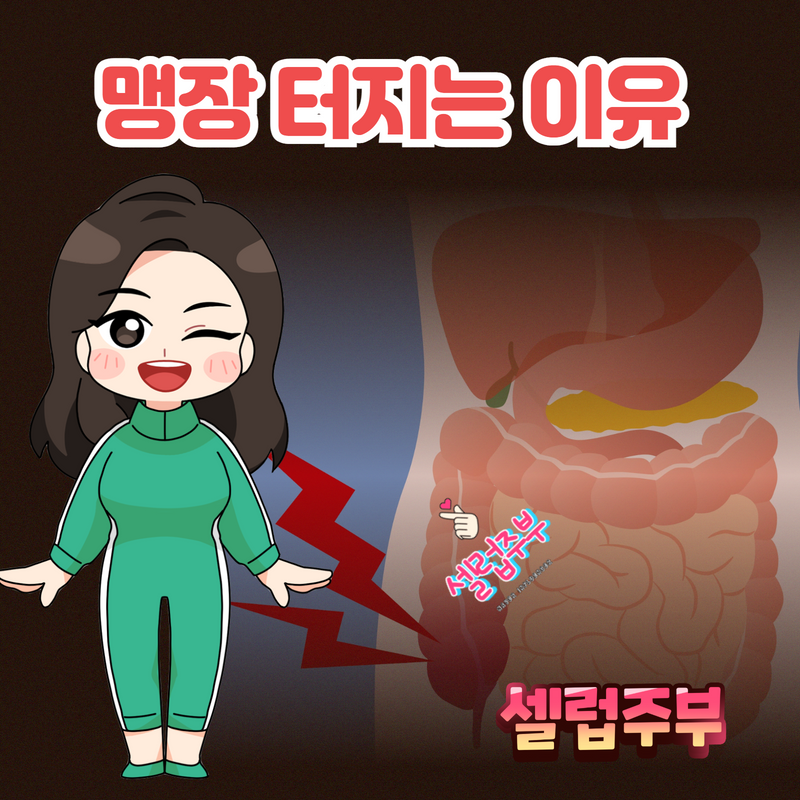 여자 맹장 위치, 맹장염 초기증상(급성/만성) 터지는 이유 ? : 네이버 블로그