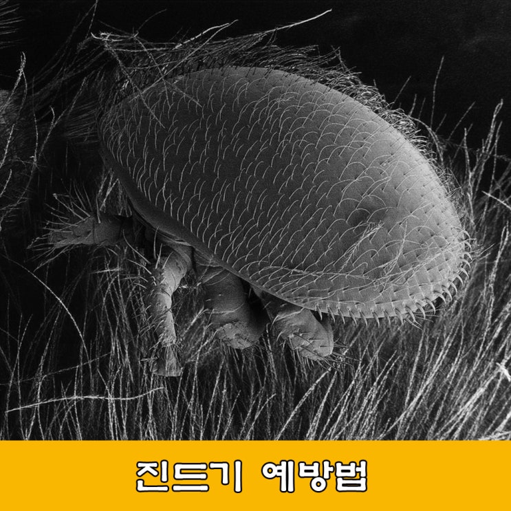  진드기. 가분다리. 진드기 물리면