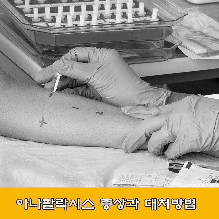 알레르기.아나팔락시스 증상과 대처 방법