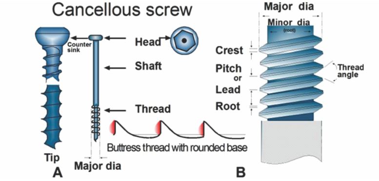 os screw 정리, os 신규, cortical, locking, lag screw, plate : 네이버 블로그
