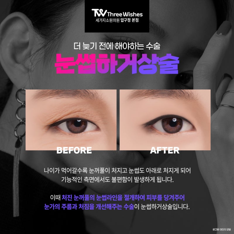 눈썹하거상술 더 늦기 전에