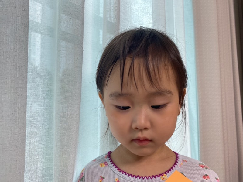 유아 백색비강진 백반증 증상 치료방법
