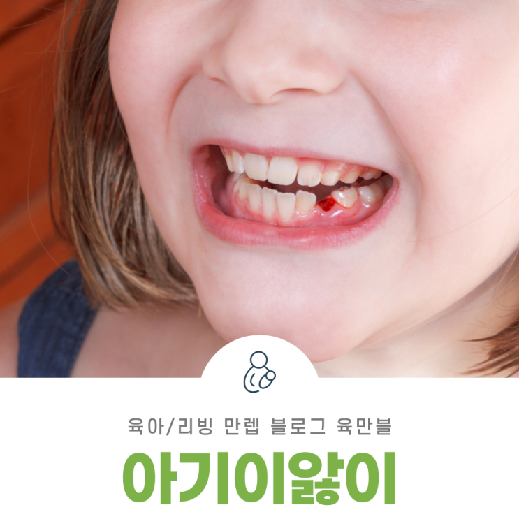  아기이앓이 이가 나는 시기와 함께 알아보자