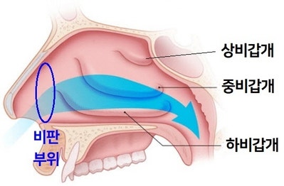 알레르기 비염, 축농증(부비강염)의 증상과 원인 치료 / 재채기, 콧물, 코막힘, 후비루, 후각 상실 3