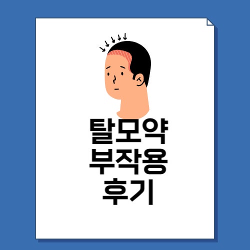  탈모약 부작용 후기 및 종류 10가지 총정리!