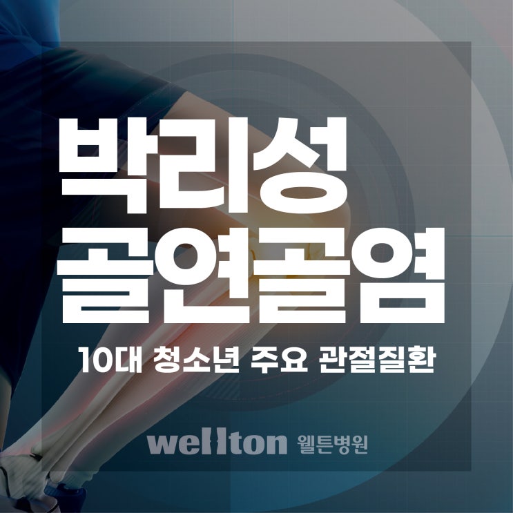  박리성 골연골염 : 10대 청소년이 주의해야 할 관절질환