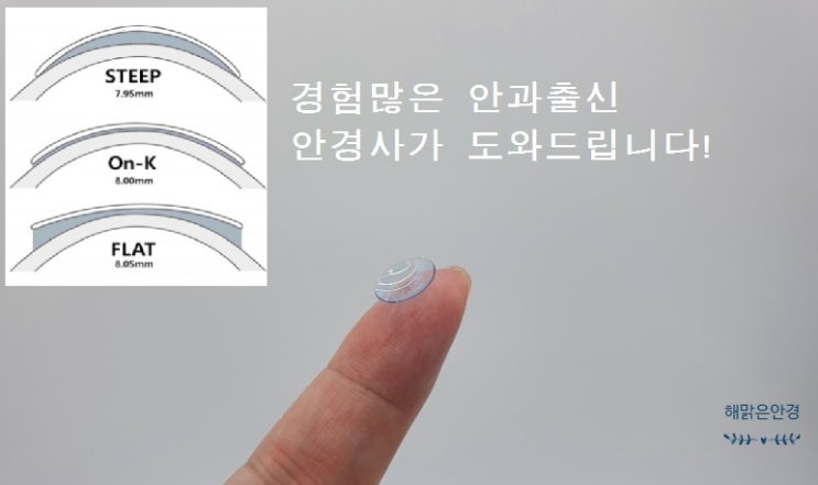  안산 하드렌즈 전문점 ,안과출신 전문안경사 가  처방하는 만족스러운 하드렌즈 (RGP) 처방사례,안산해맑은안경