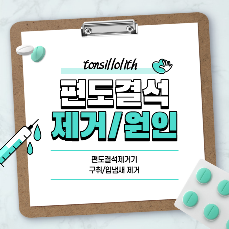  편도결석 제거 및 원인 【#편도결석제거기 #편도결석 빼는법 #구취 #입냄새 #입냄새 제거】