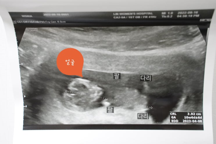  임신 3개월 배크기 태아기 진입과 젤리곰