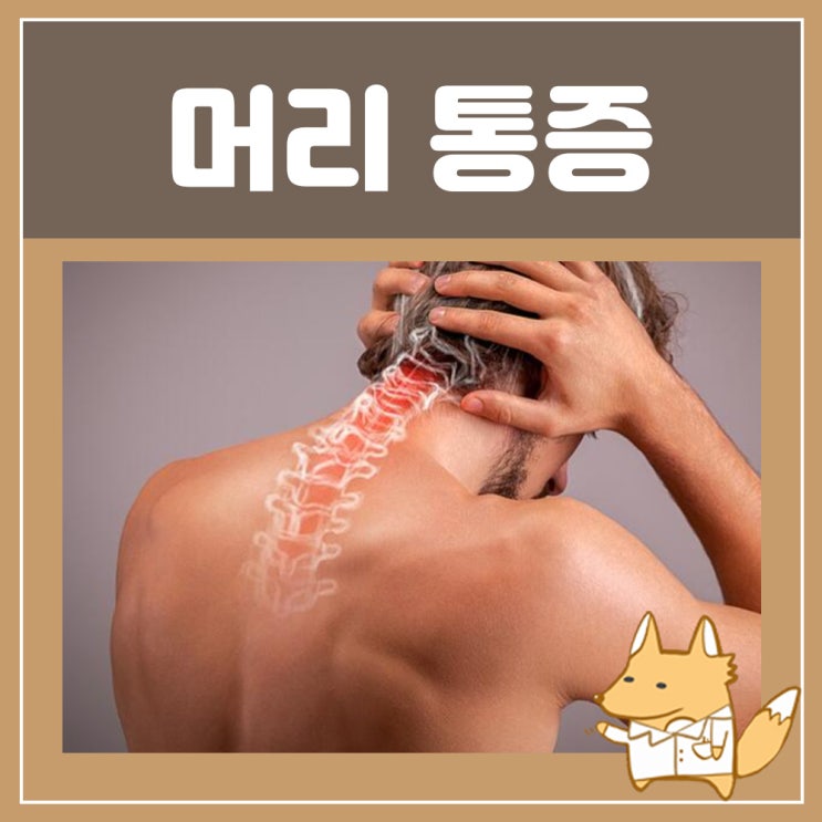  뒷머리찌릿, 오른쪽 왼쪽 뒷머리 통증 : 뒷목 뻐근 두통 후두신경통 치료