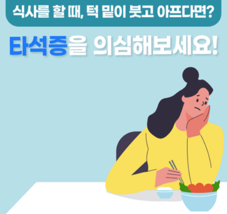  타액선(침샘, salivary gland) 질환 (3) : 타석증(침샘돌, sialolithiasis)