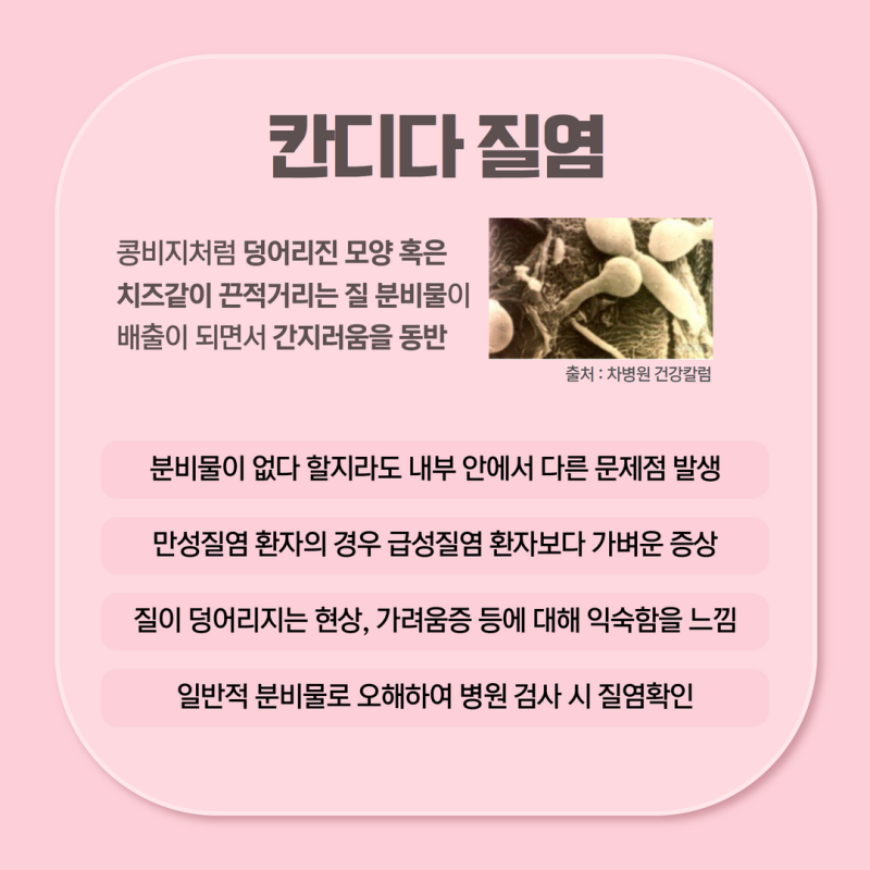 구월동 만성질염 치료 건강을 위해