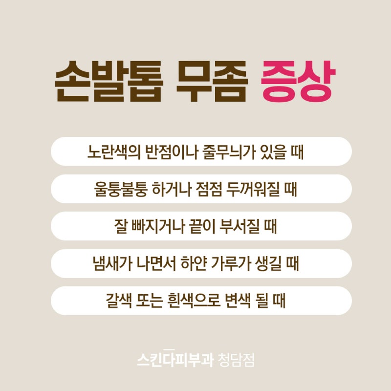 두꺼운 발톱의 원인, 발톱무좀 치료_청담피부과 2