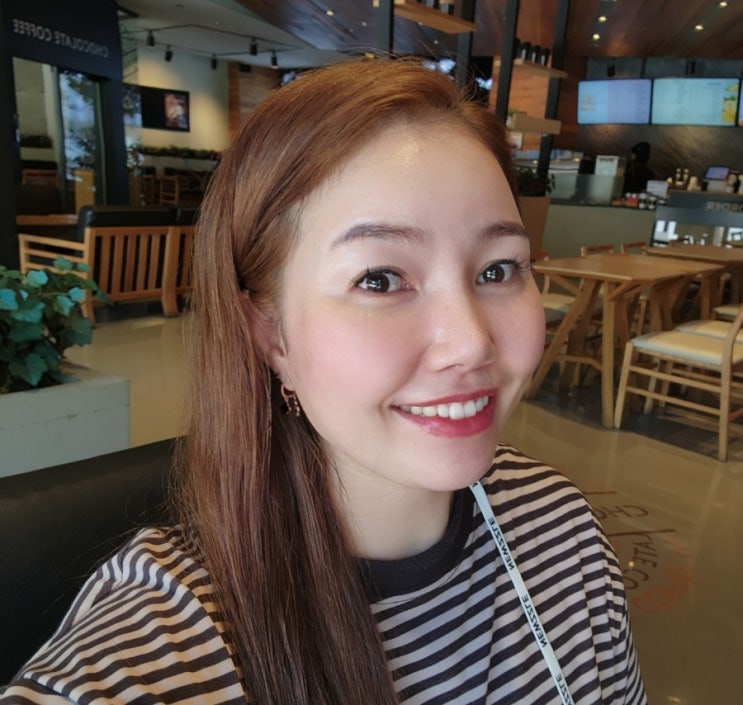  안산 울쎄라 300샷 후기 공유