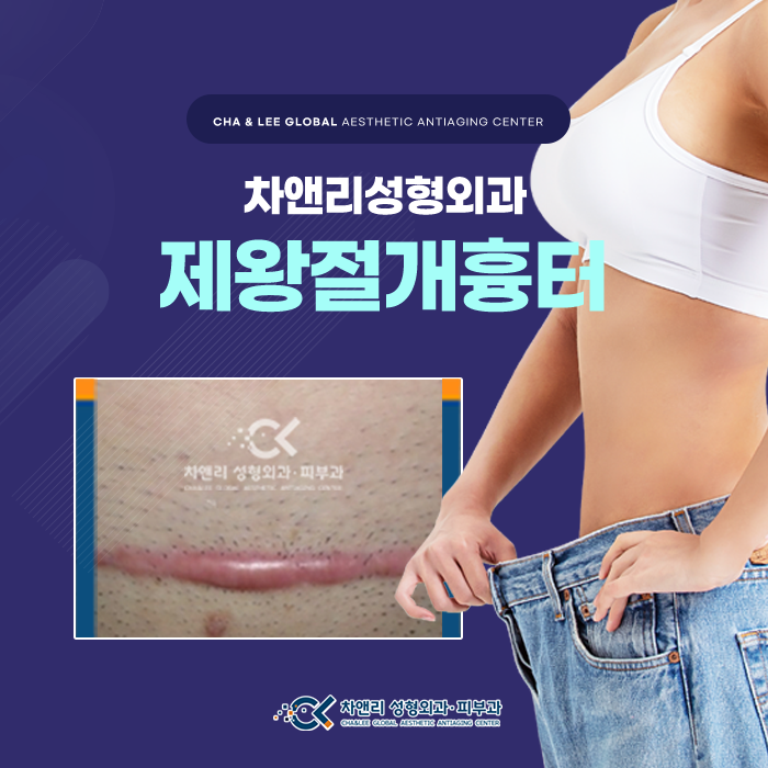  제왕절개흉터 켈로이드치료 처음이라면