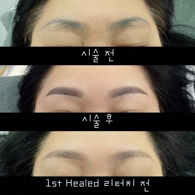미운 잔흔 눈썹, 고민이시라면 예쁘게 커버업하기 미운 잔흔 눈썹, 고민이시라면 예쁘게 커버업하기