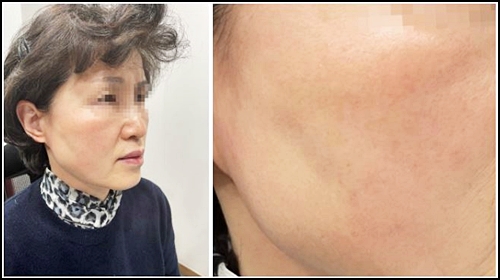  종로피부과? '이것'만은 확인하세요.