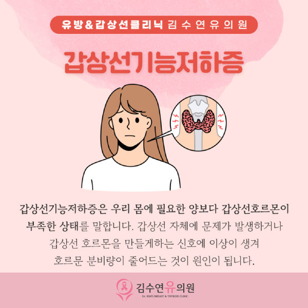 Hypothyroidism - Treat with convenient glands on butterflies! [Hydrothyroid test for hypothyroidism test